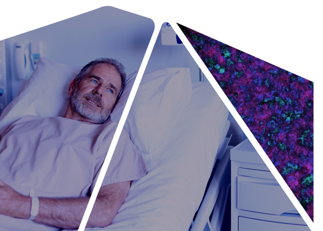 man laying in hospital bed looking away from camera